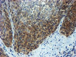 Invitrogen PPAT Monoclonal Antibody (OTI1B8) 100 &mu;L | Buy Online | Invitrogen&trade; | Fisher Scientific