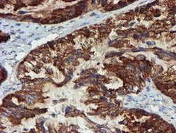 Invitrogen PPAT Monoclonal Antibody (OTI1B8) 100 &mu;L | Buy Online | Invitrogen&trade; | Fisher Scientific