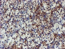 Invitrogen PPAT Monoclonal Antibody (OTI1B8) 100 &mu;L | Buy Online | Invitrogen&trade; | Fisher Scientific