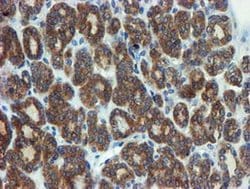 Invitrogen PPAT Monoclonal Antibody (OTI1B8) 100 &mu;L | Buy Online | Invitrogen&trade; | Fisher Scientific