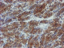 Invitrogen PPAT Monoclonal Antibody (OTI1B8) 100 &mu;L | Buy Online | Invitrogen&trade; | Fisher Scientific