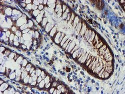 Invitrogen PPAT Monoclonal Antibody (OTI1B8) 100 &mu;L | Buy Online | Invitrogen&trade; | Fisher Scientific