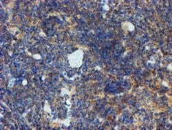 Invitrogen PPAT Monoclonal Antibody (OTI1B8) 100 &mu;L | Buy Online | Invitrogen&trade; | Fisher Scientific