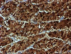 Invitrogen NQO2 Monoclonal Antibody (OTI3G4) 100 &mu;L; Unconjugated:Antibodies,