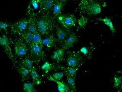 Invitrogen NQO2 Monoclonal Antibody (OTI1G2) 100 &mu;L; Unconjugated:Antibodies,
