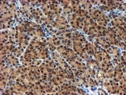 Invitrogen NQO2 Monoclonal Antibody (OTI1G2) 100 &mu;L; Unconjugated:Antibodies,