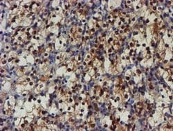 Invitrogen NQO2 Monoclonal Antibody (OTI1G2) 100 &mu;L; Unconjugated:Antibodies,