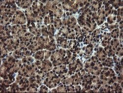 Invitrogen DOK7 Monoclonal Antibody (OTI1A9) 100 &mu;L; Unconjugated:Antibodies,
