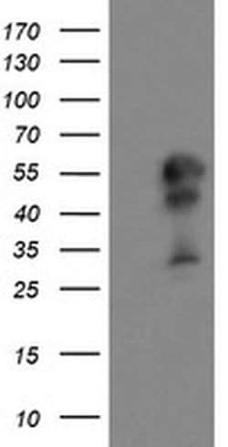 Invitrogen DOK7 Monoclonal Antibody (OTI1A9) 100 &mu;L; Unconjugated:Antibodies,