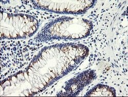 Invitrogen ACBD3 Monoclonal Antibody (OTI3E7) 100 &mu;L; Unconjugated:Anticuerpos