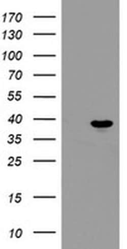 Invitrogen PPIL6 Monoclonal Antibody (OTI4F2) 100 &mu;L; Unconjugated:Antibodies,
