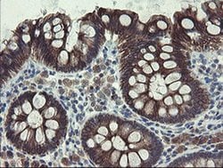 Invitrogen DPH2 Monoclonal Antibody (OTI3A12) 100 &mu;L; Unconjugated:Antibodies,