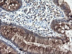 Invitrogen DPH2 Monoclonal Antibody (OTI2B12) 100 &mu;L; Unconjugated:Antibodies,
