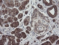 Invitrogen DPH2 Monoclonal Antibody (OTI2B12) 100 &mu;L; Unconjugated:Antibodies,