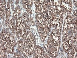 Invitrogen DPH2 Monoclonal Antibody (OTI2B12) 100 &mu;L; Unconjugated:Antibodies,