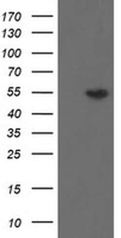 Invitrogen DPH2 Monoclonal Antibody (OTI2B12) 100 &mu;L; Unconjugated:Antibodies,
