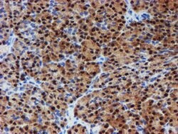 Invitrogen PGM3 Monoclonal Antibody (OTI1A11) 100 &mu;L | Buy Online | Invitrogen&trade; | Fisher Scientific