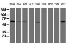 Invitrogen PGM3 Monoclonal Antibody (OTI1A11) 100 &mu;L | Buy Online | Invitrogen&trade; | Fisher Scientific