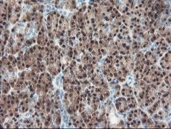 Invitrogen PGM3 Monoclonal Antibody (OTI1B8) 100 &mu;L; Unconjugated:Antibodies,