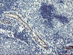 Invitrogen PGM3 Monoclonal Antibody (OTI1B8) 100 &mu;L; Unconjugated:Antibodies,