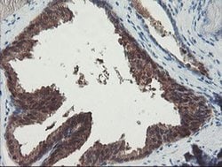 Invitrogen PGM3 Monoclonal Antibody (OTI1B8) 100 &mu;L; Unconjugated:Antibodies,