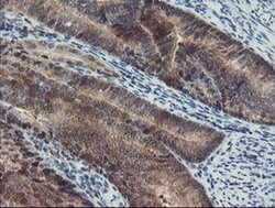 Invitrogen PGM3 Monoclonal Antibody (OTI1B8) 100 &mu;L; Unconjugated:Antibodies,