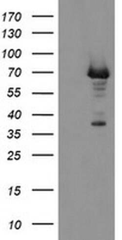 Invitrogen PGM3 Monoclonal Antibody (OTI1B8) 100 &mu;L; Unconjugated:Antibodies,