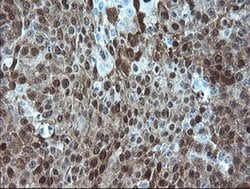 Invitrogen ADH7 Monoclonal Antibody (OTI2H10) 100 &mu;L; Unconjugated:Antibodies,