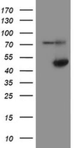 Invitrogen ADH7 Monoclonal Antibody (OTI2H10) 100 &mu;L; Unconjugated:Antibodies,