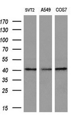 Invitrogen ADH7 Monoclonal Antibody (OTI2H10) 100 &mu;L; Unconjugated:Antibodies,