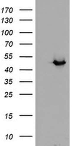 ADH7 Monoclonal Antibody (OTI2D11), Invitrogen 100 &mu;L; Unconjugated:Antibodies,