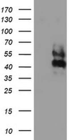 Invitrogen LRRC25 Monoclonal Antibody (OTI1C5) 100 &mu;L | Buy Online | Invitrogen&trade; | Fisher Scientific