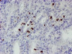 Invitrogen PADI4 Monoclonal Antibody (OTI6A2) 100 &mu;L; Unconjugated:Antibodies,