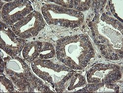 COMMD1 Monoclonal Antibody (OTI2E2):Antibodies, Monoclonal
