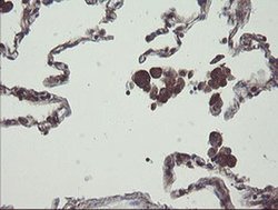 COMMD1 Monoclonal Antibody (OTI2E2):Antibodies, Monoclonal