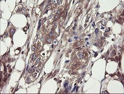 COMMD1 Monoclonal Antibody (OTI2E2):Antibodies, Monoclonal