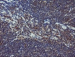 COMMD1 Monoclonal Antibody (OTI2E2):Antibodies, Monoclonal