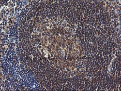 COMMD1 Monoclonal Antibody (OTI2E2):Antibodies, Monoclonal