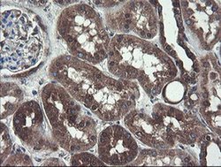 COMMD1 Monoclonal Antibody (OTI2E2):Antibodies, Monoclonal