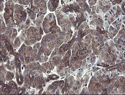 COMMD1 Monoclonal Antibody (OTI2E2):Antibodies, Monoclonal