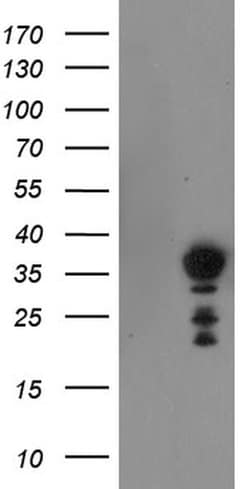 Invitrogen NRIP3 Monoclonal Antibody (OTI1A9) 100 &mu;L; Unconjugated:Antibodies,