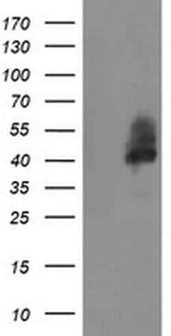 Invitrogen LRRC25 Monoclonal Antibody (OTI3E4) 100 &mu;L; Unconjugated:Antibodies,