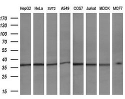 Invitrogen LRRC25 Monoclonal Antibody (OTI3E4) 100 &mu;L; Unconjugated:Antibodies,