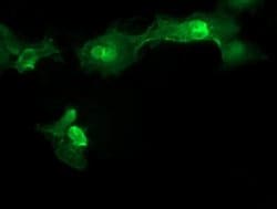 Invitrogen MMACHC Monoclonal Antibody (OTI1A4) 100 &mu;L; Unconjugated:Antibodies,