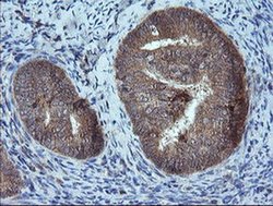 Invitrogen MMACHC Monoclonal Antibody (OTI1A4) 100 &mu;L; Unconjugated:Antibodies,