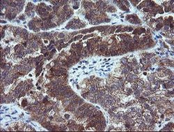 Invitrogen MMACHC Monoclonal Antibody (OTI1A4) 100 &mu;L; Unconjugated:Antibodies,