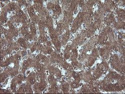 Invitrogen MMACHC Monoclonal Antibody (OTI1A4) 100 &mu;L; Unconjugated:Antibodies,