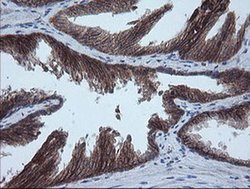 Invitrogen MMACHC Monoclonal Antibody (OTI1A4) 100 &mu;L; Unconjugated:Antibodies,