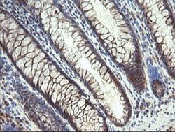 Invitrogen MMACHC Monoclonal Antibody (OTI1A4) 100 &mu;L; Unconjugated:Antibodies,