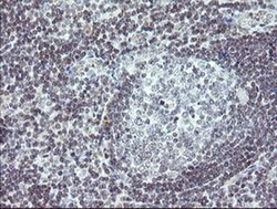 Invitrogen TPD52L3 Monoclonal Antibody (OTI3D11) 100 &mu;L; Unconjugated:Antibodies,